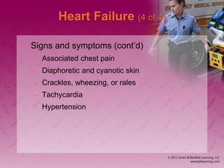 Heart Failure (4 of 4)
• Signs and symptoms (cont’d)
– Associated chest pain
– Diaphoretic and cyanotic skin
– Crackles, wheezing, or rales
– Tachycardia
– Hypertension
 