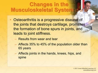 Changes in the
Musculoskeletal System (5 of 5)
• Osteoarthritis is a progressive disease of
the joints that destroys cartilage, promotes
the formation of bone spurs in joints, and
leads to joint stiffness.
– Results from wear and tear
– Affects 35% to 45% of the population older than
65 years
– Affects joints in the hands, knees, hips, and
spine
 