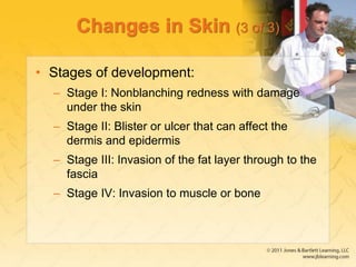 Changes in Skin (3 of 3)
• Stages of development:
– Stage I: Nonblanching redness with damage
under the skin
– Stage II: Blister or ulcer that can affect the
dermis and epidermis
– Stage III: Invasion of the fat layer through to the
fascia
– Stage IV: Invasion to muscle or bone
 