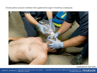 Prehospital Emergency Care, 10th
edition
Mistovich | Karren
Copyright © 2014, 2010, 2008 by Pearson Education, Inc.
All Rights Reserved
Provide positive pressure ventilation with supplemental oxygen if breathing is inadequate.
continued on next slide
 