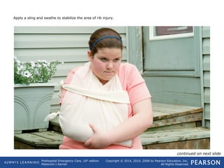 Prehospital Emergency Care, 10th
edition
Mistovich | Karren
Copyright © 2014, 2010, 2008 by Pearson Education, Inc.
All Rights Reserved
Apply a sling and swathe to stabilize the area of rib injury.
continued on next slide
 