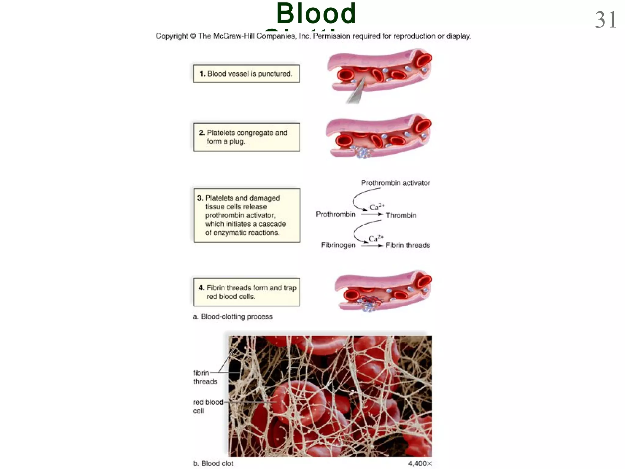 31Blood
Clotting
 