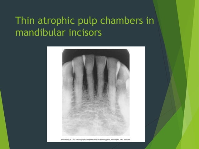 Chapter 35: Interpretation of Trauma, Pulpal Lesions, and Periapical ...