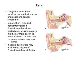 Care of The Patients ears - Nurses Revision
