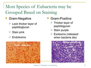 Most Species of Eubacteria may be
Grouped Based on Staining


Gram-Negative







Lack thicker layer of
peptidoglyca...