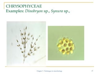 CHRYSOPHYCEAE
Examples: Dinobryon sp., Synura sp.,

Chapter 3 : Techniques in microbiology

47

 
