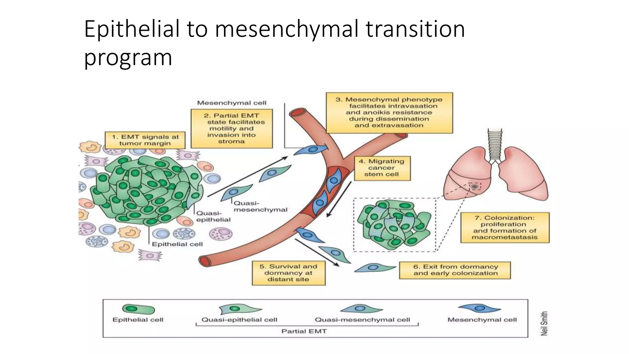 Epithelial to mesenchymal transition
program
 