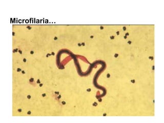 Microfilaria…
 