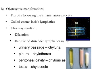 b) Obstructive manifestations
• Fibrosis following the inflammatory process
• Coiled worms inside lymphatics.
• This may result in:
 Dilatation
 Rupture of distended lymphatics in the
 urinary passage – chyluria
 pleura – chylothorax
 peritoneal cavity – chylous ascitis
 testis – chylocoele
 