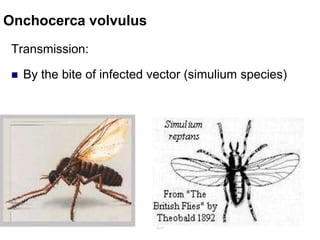 Onchocerca volvulus
Transmission:
 By the bite of infected vector (simulium species)
229
 