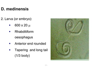 D. medinensis
2. Larva (or embryo):
 600 x 20 
 Rhabditiform
oesophagus
 Anterior end rounded
 Tapering and long tail
(1/3 body)
273
 