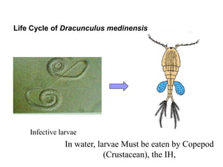 Life Cycle of Dracunculus medinensis
Infective larvae
In water, larvae Must be eaten by Copepod
(Crustacean), the IH,
 