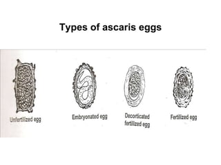 Types of ascaris eggs
 