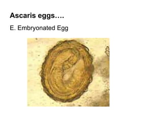 Ascaris eggs….
E. Embryonated Egg
 