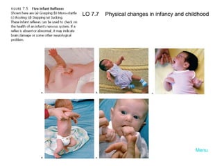 LO 7.7

Physical changes in infancy and childhood

Menu

 