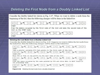 Deleting the First Node from a Doubly Linked List
 