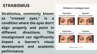 CHAPTER 3 PPT ABOUT LEARNERS WITH DIFFICULTY SEEING AND HEARING | PDF