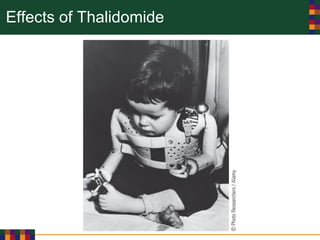 Effects of Thalidomide
 