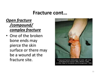 Fracture cont…
Open fracture
/compound/
complex fracture
• One of the broken
bone ends may
pierce the skin
surface or there may
be a wound at the
fracture site.
33
 