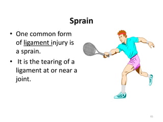 Sprain
• One common form
of ligament injury is
a sprain.
• It is the tearing of a
ligament at or near a
joint.
61
 