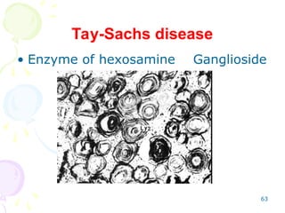 63
Tay-Sachs disease
• Enzyme of hexosamine Ganglioside
 