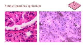 Simple squamous epithelium
 