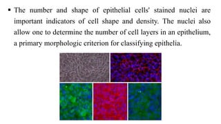  The number and shape of epithelial cells' stained nuclei are
important indicators of cell shape and density. The nuclei also
allow one to determine the number of cell layers in an epithelium,
a primary morphologic criterion for classifying epithelia.
 