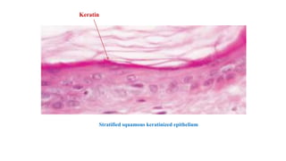 Stratified squamous keratinized epithelium
Keratin
 