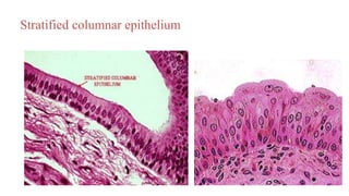 Stratified columnar epithelium
 
