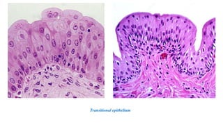 Transitional epithelium
 