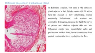 Holocrine secretion in a sebaceous gland
In holocrine secretion, best seen in the sebaceous
gland adjacent to hair follicles, entire cells fill with a
lipid-rich product as they differentiate. Mature
(terminally differentiated) cells separate and
completely disintegrate, releasing the lipid that serves
to protect and lubricate adjacent skin and hair.
Sebaceous glands lack myoepithelial cells; cell
proliferation inside a dense, inelastic connective tissue
capsule continuously forces product into the duct.
 