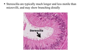  Stereocilia are typically much longer and less motile than
microvilli, and may show branching distally
 