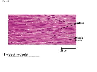 Fig. 40-5l
Smooth muscle
Nucleus
Muscle
fibers
25 µm
 