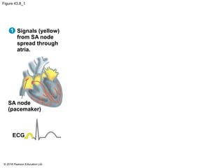 Figure 43.8_1
Signals (yellow)
from SA node
spread through
atria.
SA node
(pacemaker)
ECG
1
© 2018 Pearson Education Ltd.
 