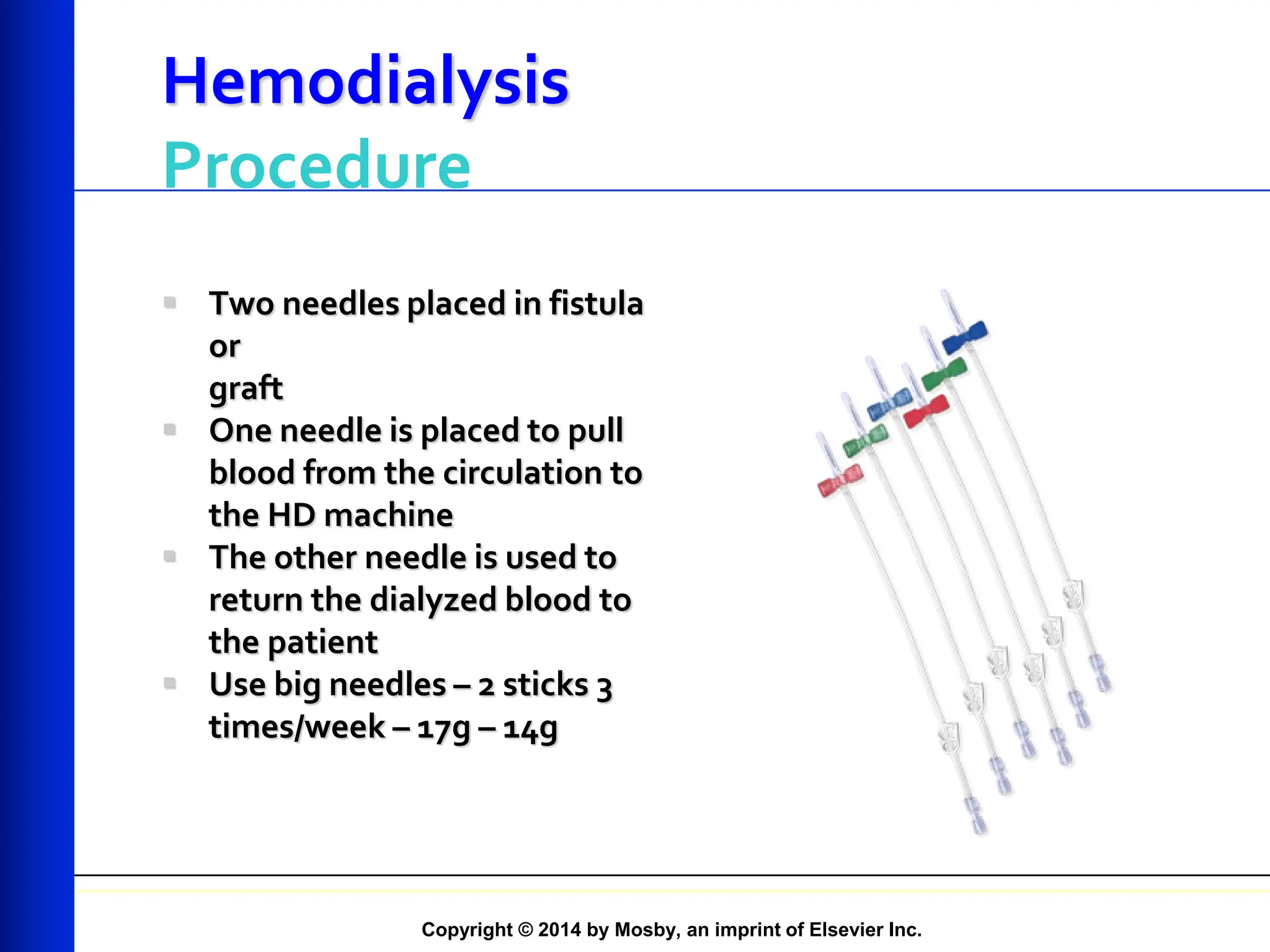 Copyright © 2014 by Mosby, an imprint of Elsevier Inc.
Hemodialysis
Procedure
 Two needles placed in fistula
or
graft
 One needle is placed to pull
blood from the circulation to
the HD machine
 The other needle is used to
return the dialyzed blood to
the patient
 Use big needles – 2 sticks 3
times/week – 17g – 14g
 