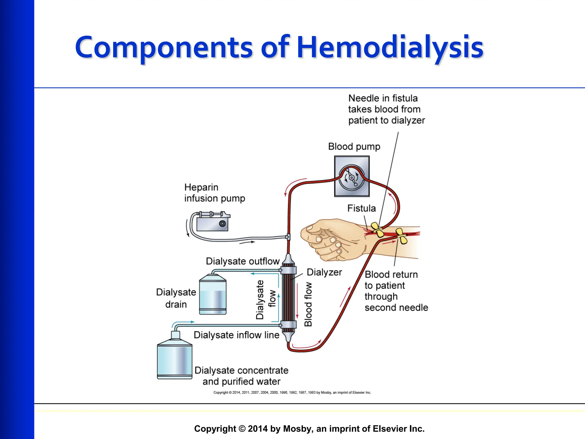 Copyright © 2014 by Mosby, an imprint of Elsevier Inc.
Components of Hemodialysis
 