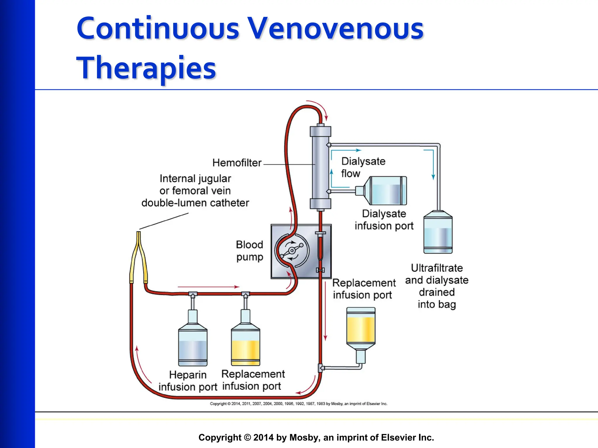 Copyright © 2014 by Mosby, an imprint of Elsevier Inc.
Continuous Venovenous
Therapies
 