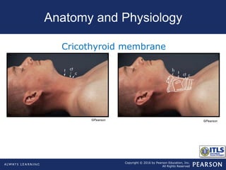 Copyright © 2016 by Pearson Education, Inc.
All Rights Reserved
Anatomy and Physiology
Cricothyroid membrane
©Pearson ©Pearson
 