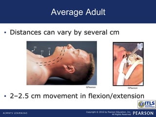 Copyright © 2016 by Pearson Education, Inc.
All Rights Reserved
Average Adult
• Distances can vary by several cm
• 2–2.5 cm movement in flexion/extension
©Pearson ©Pearson
 