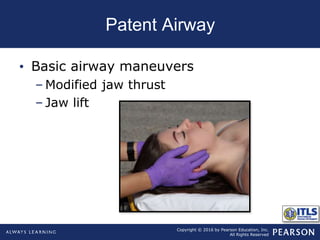 Copyright © 2016 by Pearson Education, Inc.
All Rights Reserved
Patent Airway
• Basic airway maneuvers
– Modified jaw thrust
– Jaw lift
 