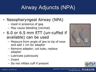 Copyright © 2016 by Pearson Education, Inc.
All Rights Reserved
Airway Adjuncts (NPA)
• Nasopharyngeal Airway (NPA)
– Used in presence of gag
– May cause bleeding (normal)
• 6.0 or 6.5 mm ETT (un-cuffed if
available) can be used
– Measure from angle of jaw to tip of nose
and add 1 cm for adapter
– Remove adapter, cut tube, replace
adapter
– Lubricate judiciously
– Insert
– Do not inflate cuff if present
 