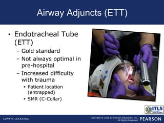 Copyright © 2016 by Pearson Education, Inc.
All Rights Reserved
Airway Adjuncts (ETT)
• Endotracheal Tube
(ETT)
– Gold standard
– Not always optimal in
pre-hospital
– Increased difficulty
with trauma
 Patient location
(entrapped)
 SMR (C-Collar)
 
