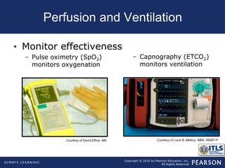 Copyright © 2016 by Pearson Education, Inc.
All Rights Reserved
Perfusion and Ventilation
• Monitor effectiveness
– Pulse oximetry (SpO2)
monitors oxygenation
– Capnography (ETCO2)
monitors ventilation
Courtesy of David Effron, MD Courtesy of Louis B. Mallory, MBA, REMT-P
 