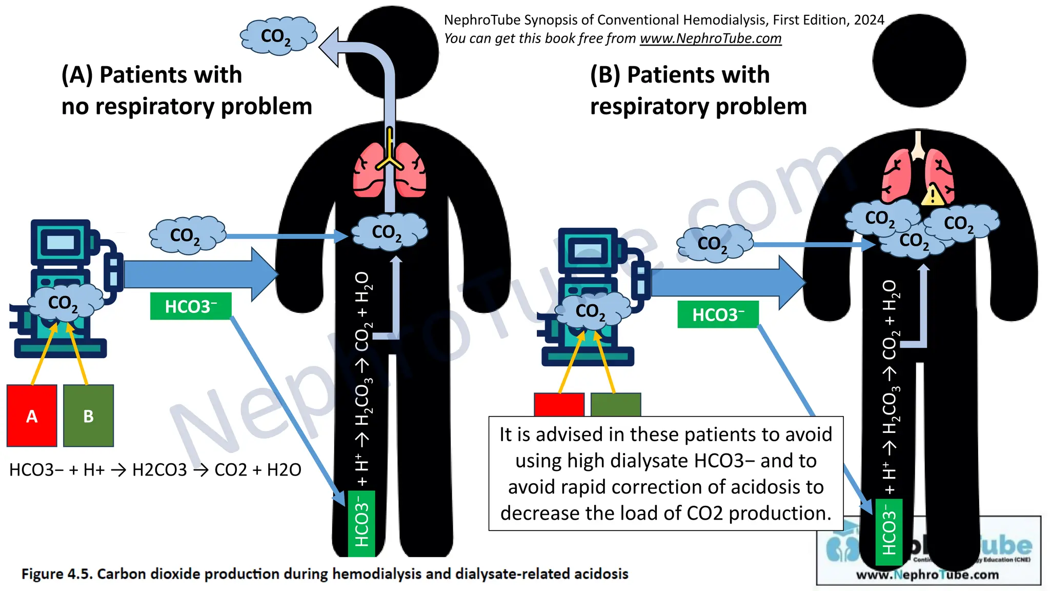 Hemodialysis Chapter 4 Dialysate Circuit Dr Gawad Pdf