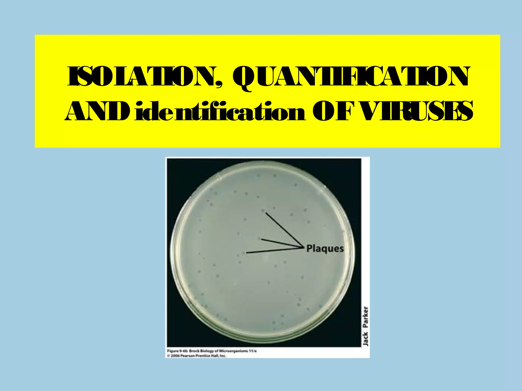 ISOL ION, QUANT ICAT
    AT              IF   ION
AND identification OF VIRUSES
 