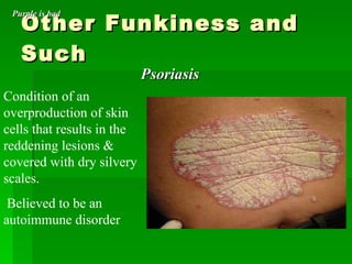 Other Funkiness and Such  Psoriasis  Condition of an overproduction of skin cells that results in the reddening lesions & covered with dry silvery scales. Believed to be an autoimmune disorder Purple is bad 