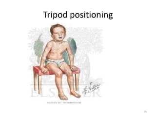 Tripod positioning
76
 