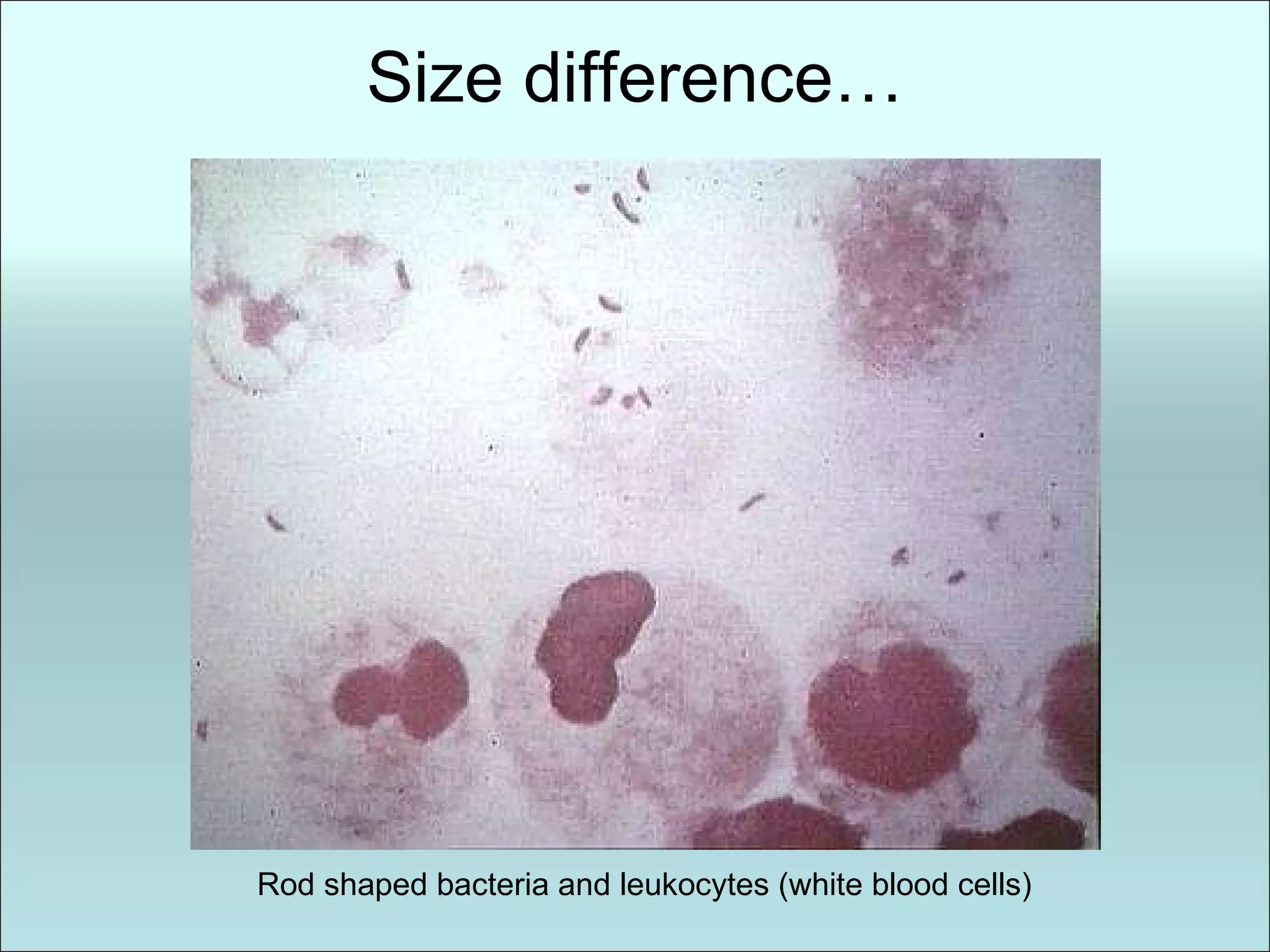 Size difference… Rod shaped bacteria and leukocytes (white blood cells) 