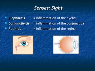 Senses: Sight




Blepharitis
Conjunctivitis
Retinitis

= inflammation of the eyelid
= inflammation of the conjunctiva
= inflammation of the retina

 