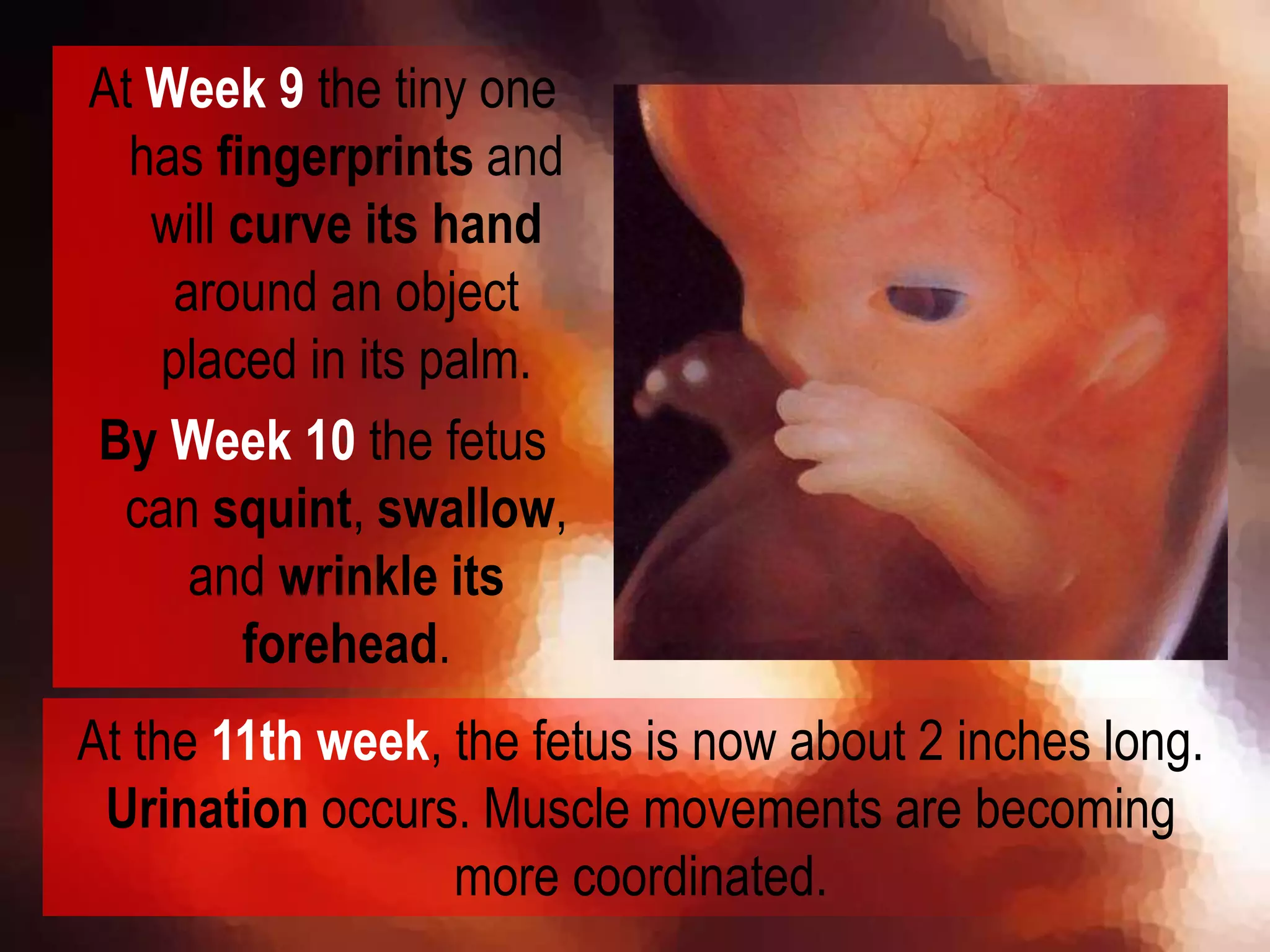 At Week 9 the tiny one
has fingerprints and
will curve its hand
around an object
placed in its palm.
By Week 10 the fetus
can squint, swallow,
and wrinkle its
forehead.
At the 11th week, the fetus is now about 2 inches long.
Urination occurs. Muscle movements are becoming
more coordinated.
 
